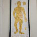 Acupuncture picture